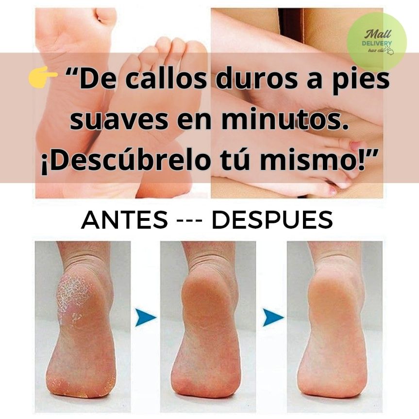 Removedor De Callos Y Exfoliante De Pies